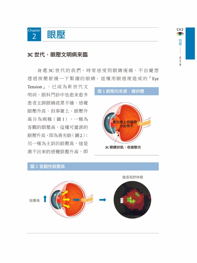 方一強眼科評價 Onnoro